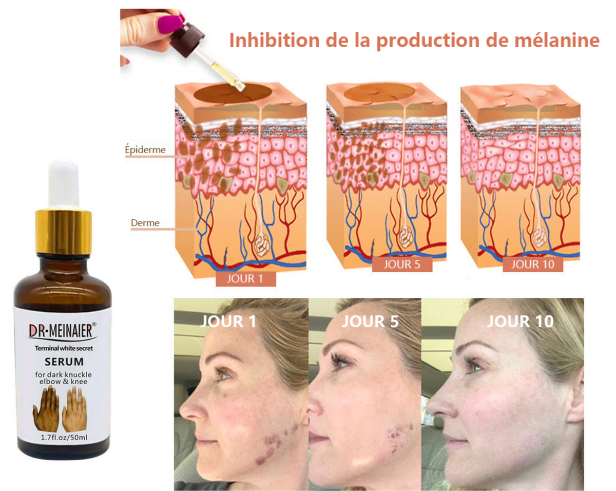 ✨Sérum Correcteur des Taches Brunes – * Sérum Visage Anti-Mélanine
