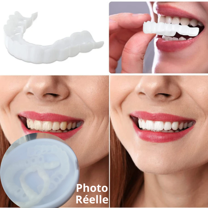 Kit de Facettes Dentaires Snap on Smile™