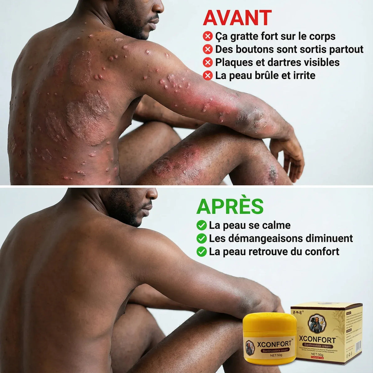 X-CONFORT - CRÈME DE CONFORT POUR LA PEAU