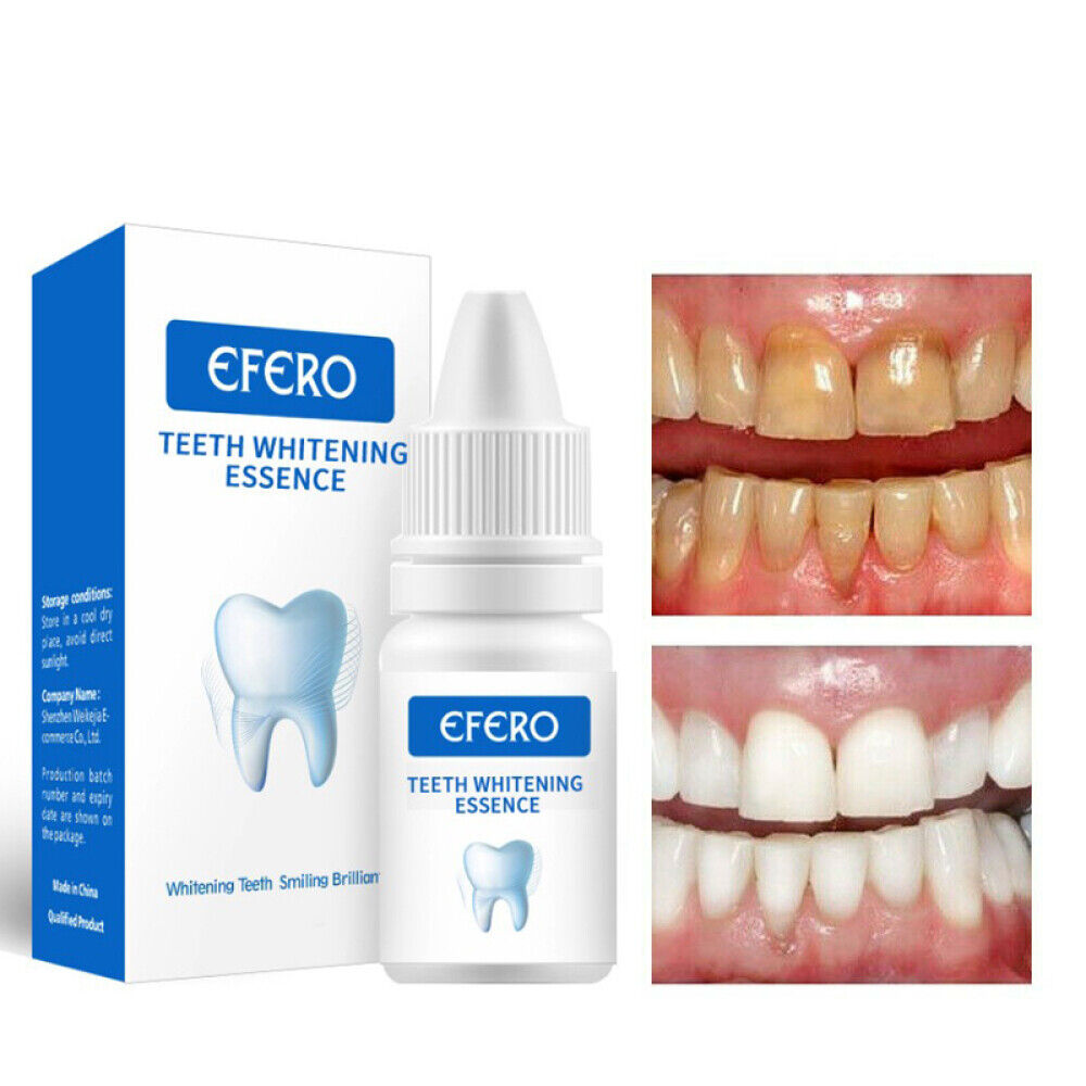 ESSENCE DE BLANCHIMENT DES DENTS