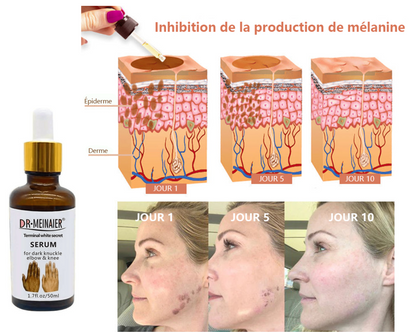 ✨Sérum Correcteur des Taches Brunes – * Sérum Visage Anti-Mélanine