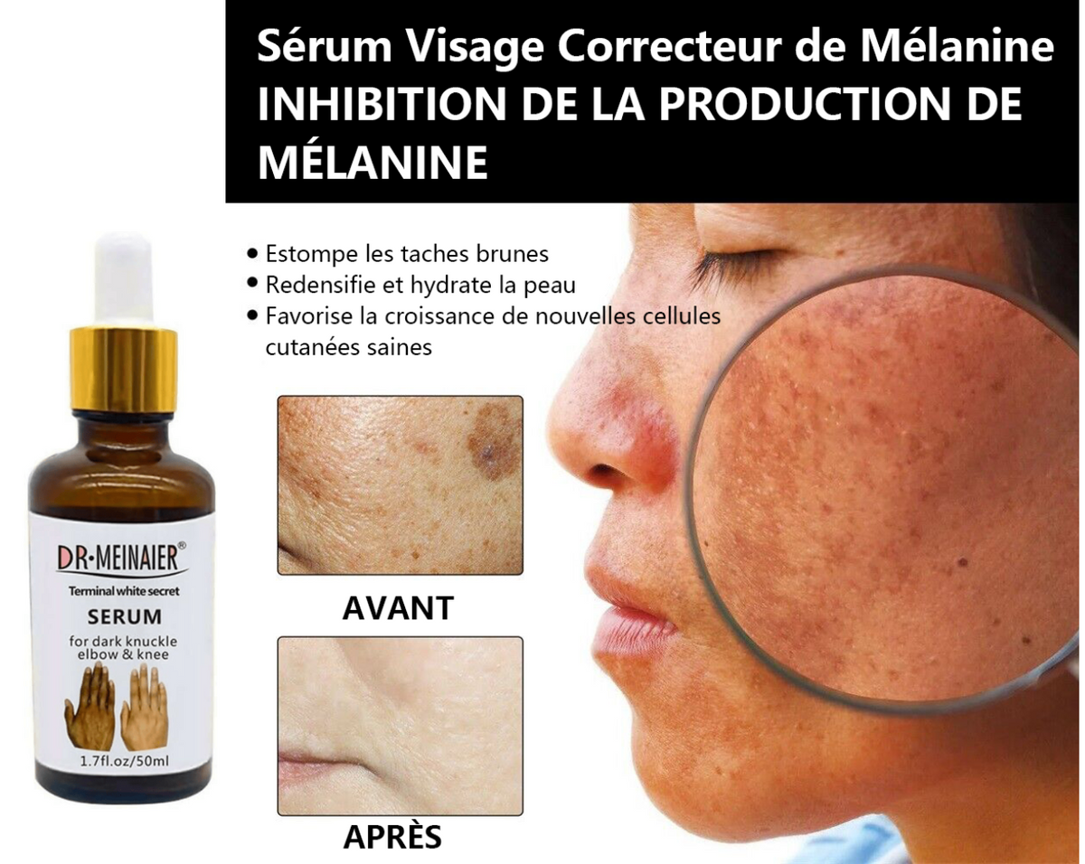 ✨Sérum Correcteur des Taches Brunes – * Sérum Visage Anti-Mélanine