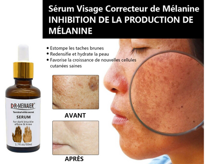 ✨Sérum Correcteur des Taches Brunes – * Sérum Visage Anti-Mélanine