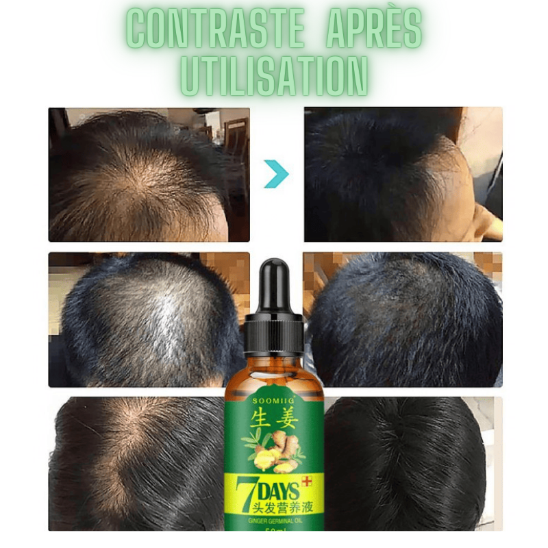 DayHair™ Spray croissance cheveux  pour hommes et femmes