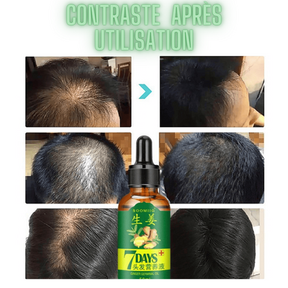 DayHair™ Spray croissance cheveux  pour hommes et femmes