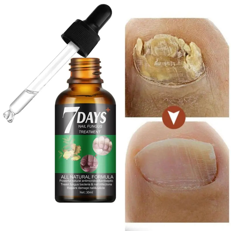 7 Days Serum — Transformez vos ongles abîmés en seulement une semaine !