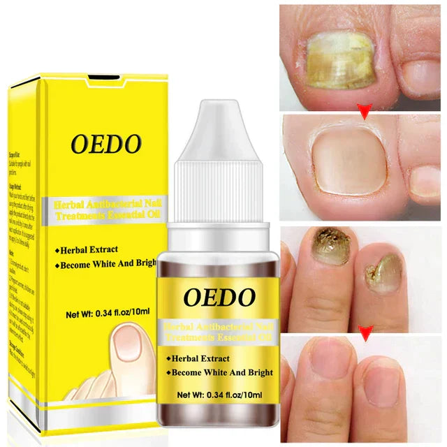OEDO™ Sérum de croissance et de renforcement des ongles de 7-jours