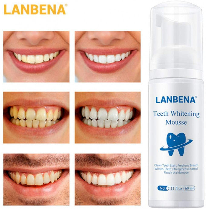 Mousse de blanchiment des dents & élimination de la mauvaise haleine