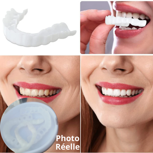 Kit de Facettes Dentaires Snap on Smile™