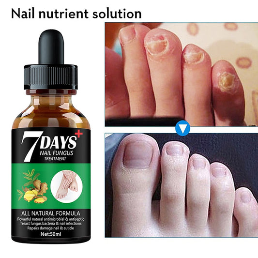 Essence de traitement des mycoses des ongles 7DAYS