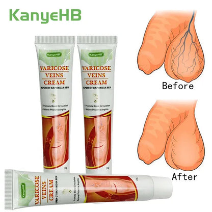01 crèmes pour varices génitales