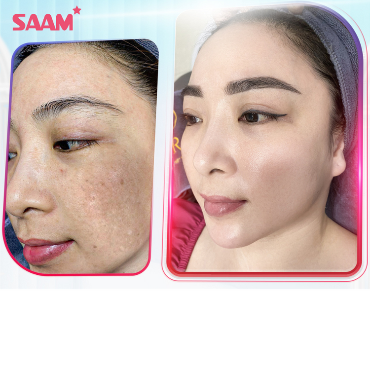 Crème SAAM Anti-Taches Mélasma & Tâches hyperpigmentaires & Éclaircissante.....