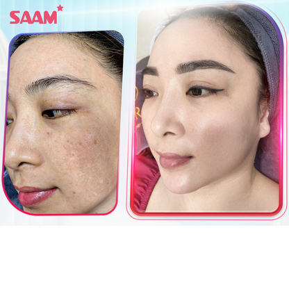 Crème SAAM Anti-Taches Mélasma & Tâches hyperpigmentaires & Éclaircissante