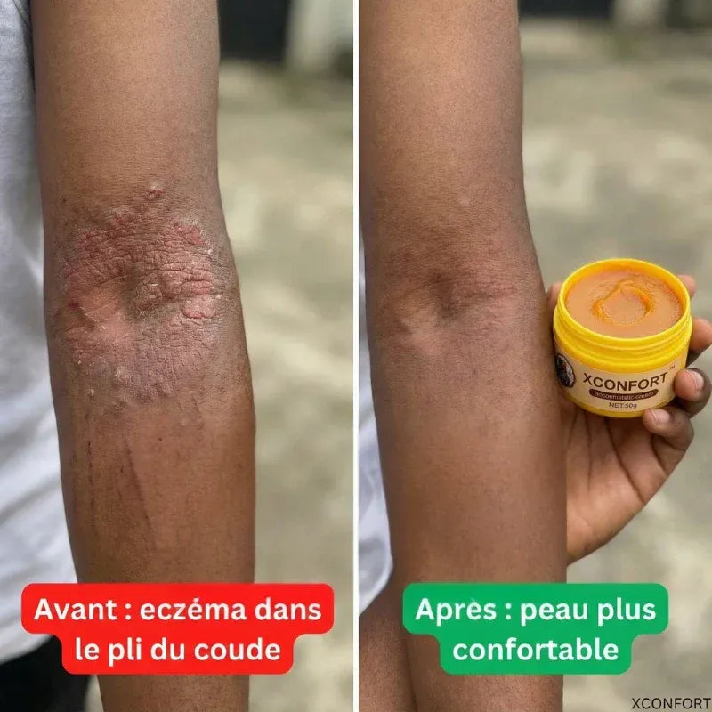X-CONFORT - CRÈME DE CONFORT POUR LA PEAU