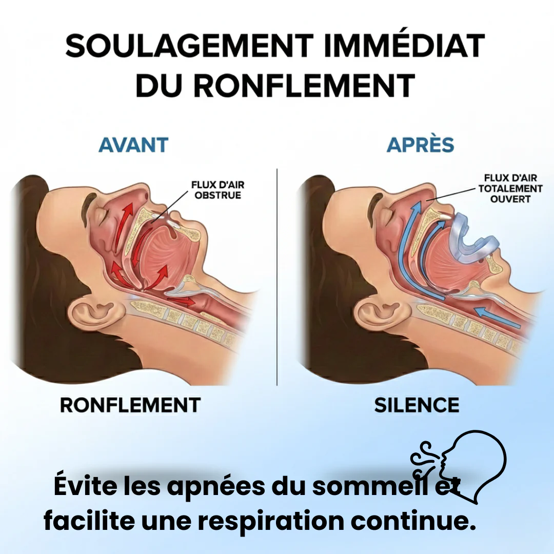 Somnra - Embout Buccal Anti-Ronflement