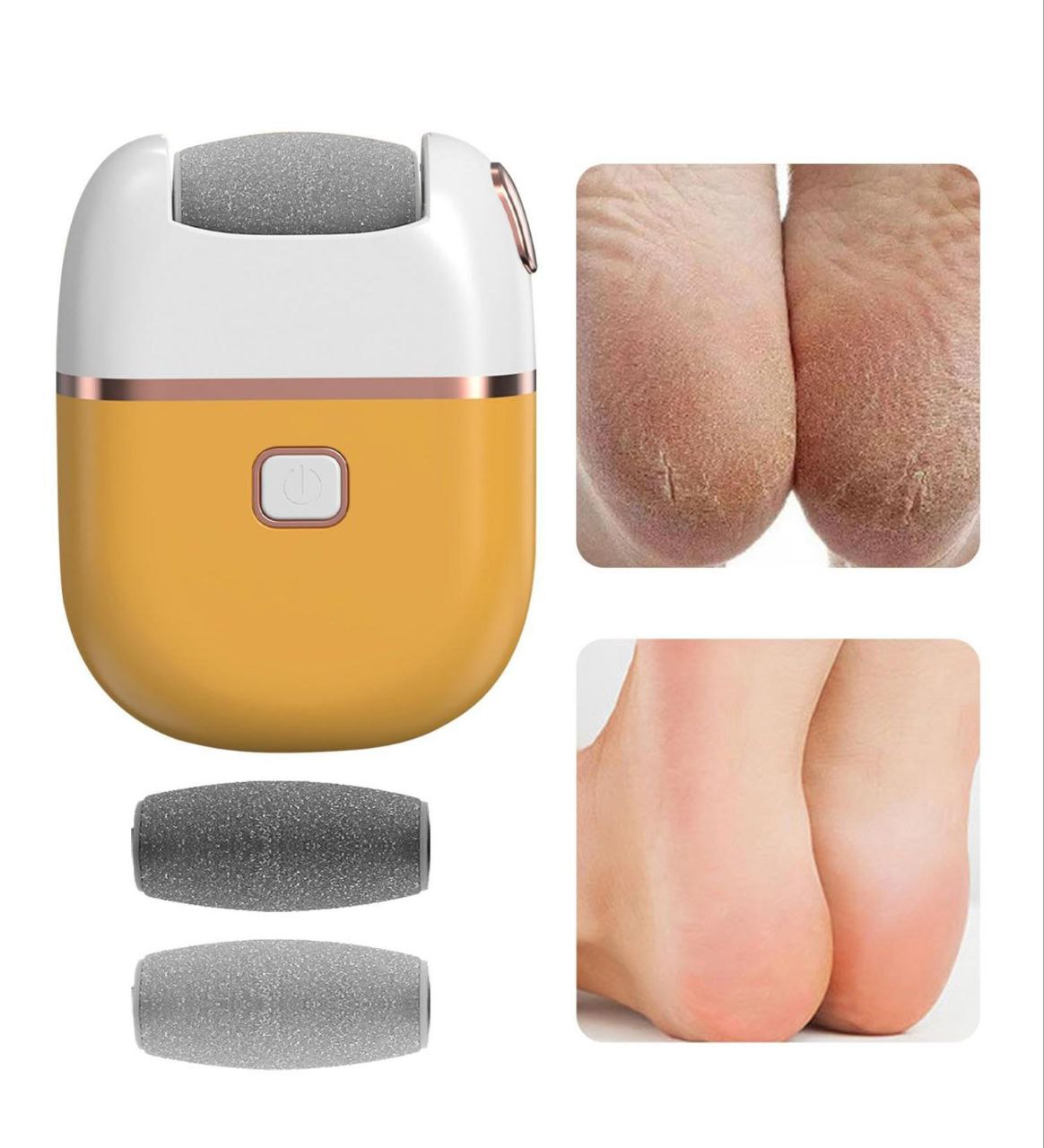 Appareil de Pédicure -Votre alliée beauté pour des pieds doux et impeccables à la maison !