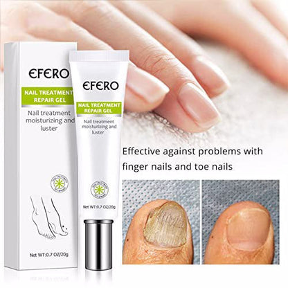 Nail™ - Ongles antifongiques Premium