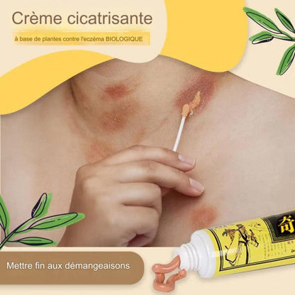 Traitement qui élimine définitivement l'eczéma, le psoriasis et les démangeaisons